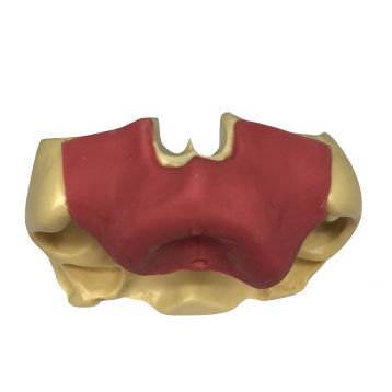 Modello anatomico sinusale - ZYG - 102  - Selmodels SL - per chirurgia odontoiatrica / per rialzo del seno nasale