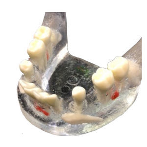 Modello anatomico di mandibola - APIC-3 - Selmodels SL - di denti / per estrazione dentale / trasparente