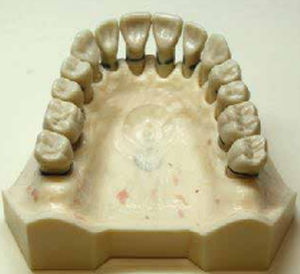 Modello anatomico osseo - DM 127 - Selmodels SL - di denti / per parodonzia / per malattie dentali