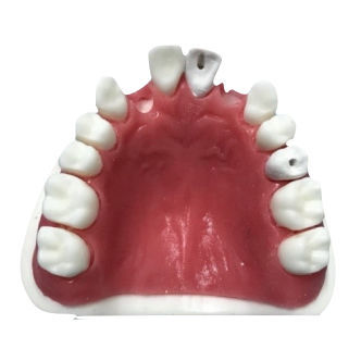 Modello anatomico di mascella - SS – 101  - Selmodels SL - di canale radicolare / didattico / per sutura