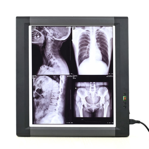 Negativoscopio digitale - MG01 - Nanchang Micare Medical Equipment - 1 corpo / con interruttore / LED