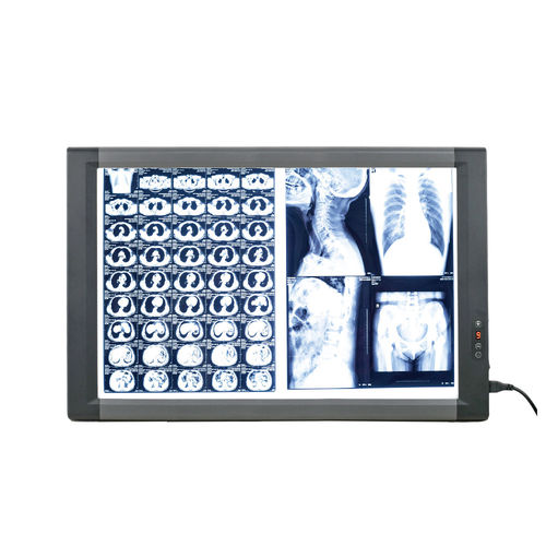 Negativoscopio digitale - MG02 - Nanchang Micare Medical Equipment - 2 corpi / con interruttore / LED