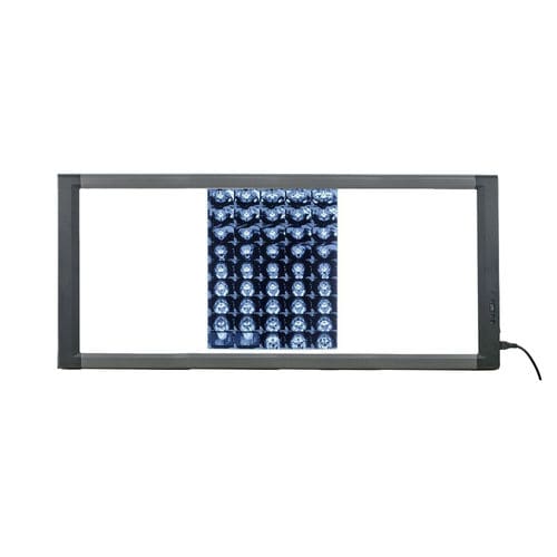 Negativoscopio digitale - MG03 - Nanchang Micare Medical Equipment - 3 corpi / con interruttore / LED