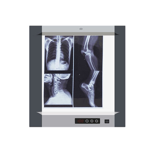 Negativoscopio digitale - MG-01 - Nanchang Micare Medical Equipment - 1 corpo / a luce bianca / con interruttore
