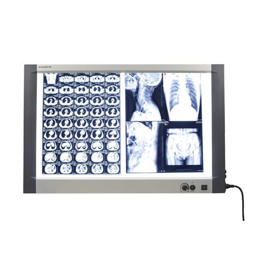 Negativoscopio 2 corpi - MG-02X - Nanchang Micare Medical Equipment - a luce bianca / con interruttore / per mammografia