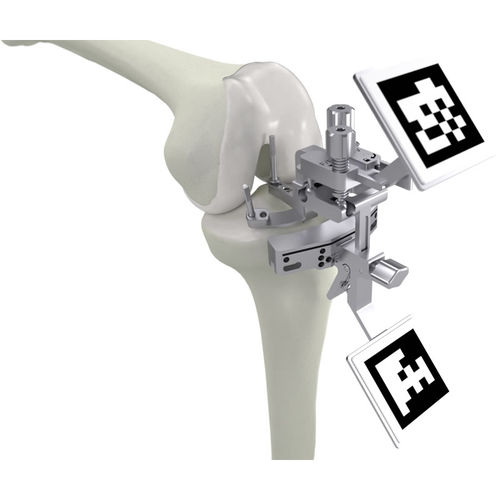 Sistema di analisi movimento del LCA - PIXEE KNEE + - Gruppo Bioimpianti - cinematica del ginocchio / con visualizzazione 3D