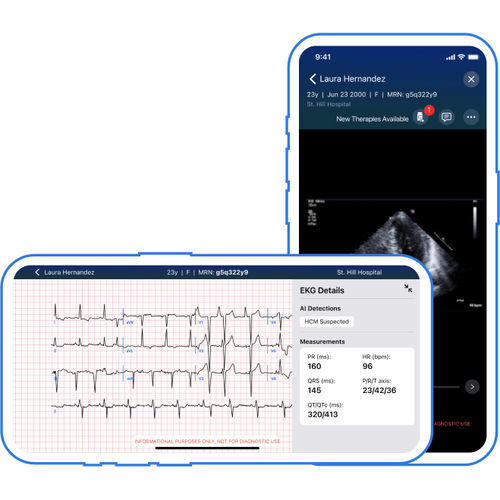 Applicazione mobile di trattamento - Viz.ai - per reportistica / diagnostica / per ECG