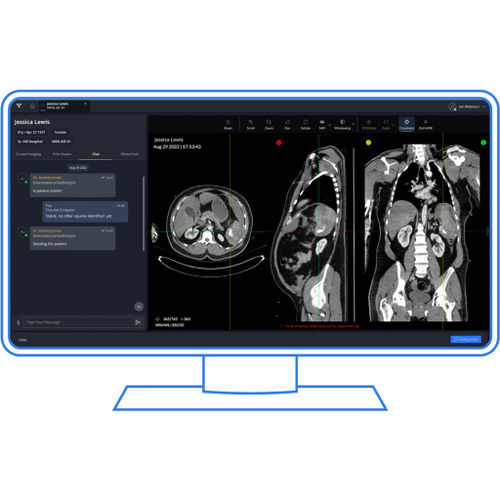 Software per traumatologia - Viz.ai - per reportistica / visualizzatore / di condivisione