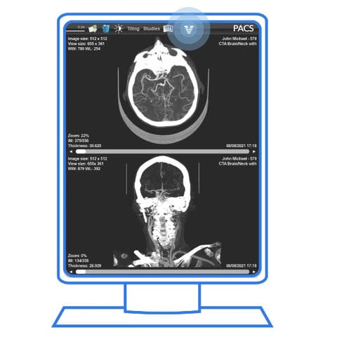 PACS con cloud computing - Viz.ai - per diagnostica per immagini / medico