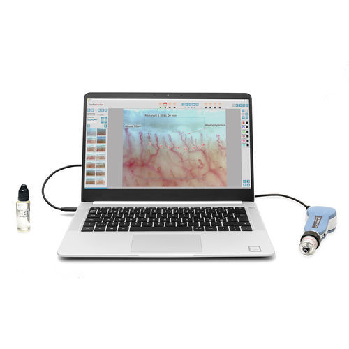 Capillaroscopio video - DM-120 CapiScope series - Inspectis - per PC