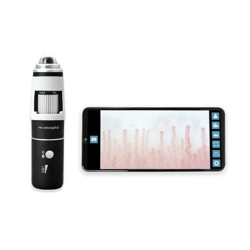 Capillaroscopio video - DM-110 DigiScope - Inspectis - per smartphone / per tablet