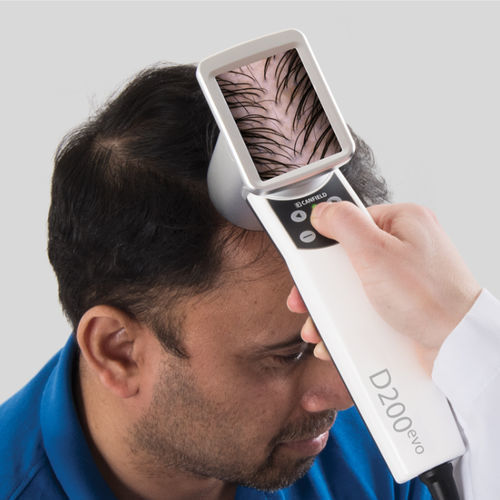 Tricoscopio video - HairMetrix® - CANFIELD - per PC
