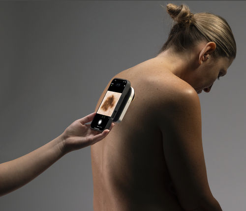 Dermatoscopio LED bianca - VEOS® - CANFIELD