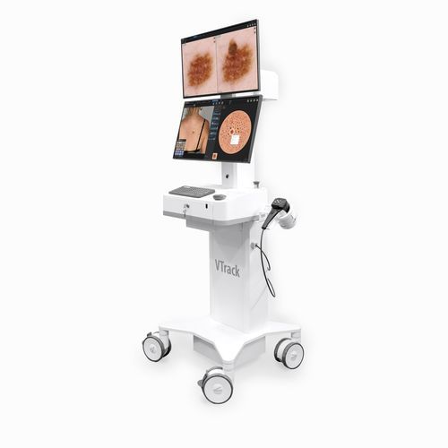 Videodermatoscopio - VTRACK 4.0 - CANFIELD - LED bianca / per PC / Full HD