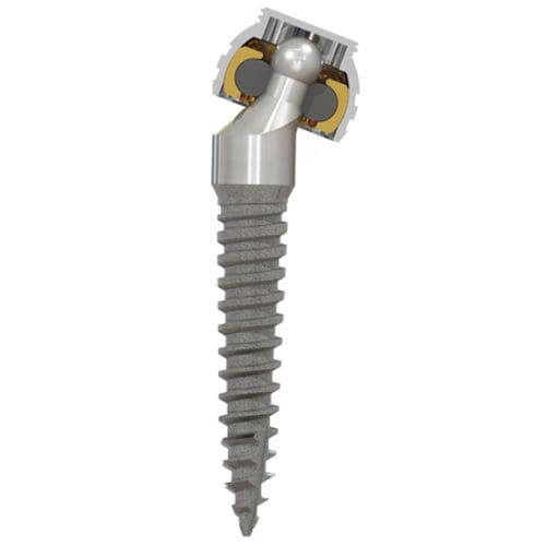 Impianto dentale in titanio - SATURNO® - Zest Dental Solutions - sferico / angolare / stretto