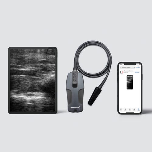 Ecografo veterinario portatile - BL Tecnoscan - Tecnovet - multiuso / con sonda wireless