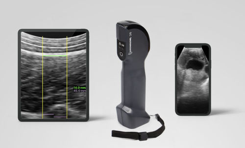 Ecografo veterinario portatile - SC Tecnoscan  - Tecnovet - multiuso / con sonda wireless