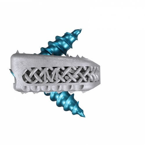 Gabbia intersomatica cervicale - Magnolis® Z - Maxxspine Innovative - via anteriore