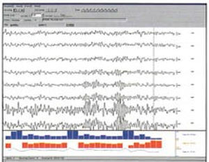 Software di analisi - SleepSign™ - Muromachi Kikai - per EMG / per studio veterinario