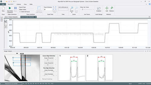 Software di analisi - MyoVIEW - Danish Myo Technology A.S (DMT) - di gestione / di controllo / di acquisizione