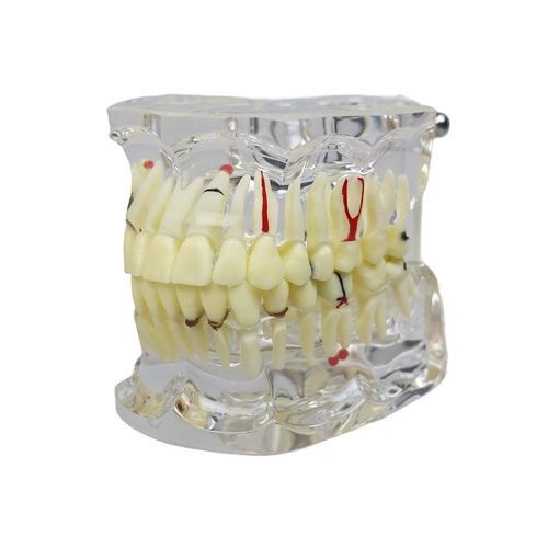 Modello anatomico di dentatura - JG-Y15-IM - FOSHAN JINGLE MEDICAL EQUIPMENT CO., LTD - di canale radicolare / odontoiatrico / in resina