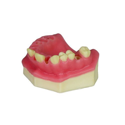Modello anatomico gengivale - JG-Y8-F3 - FOSHAN JINGLE MEDICAL EQUIPMENT CO., LTD - osseo / per chirurgia / didattico