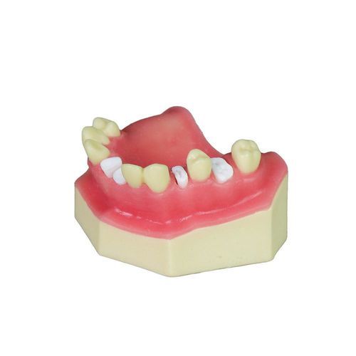 Modello anatomico di seno nasale - JG-Y8-F5 - FOSHAN JINGLE MEDICAL EQUIPMENT CO., LTD - odontoiatrico / gengivale / di mascella