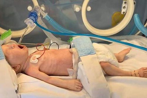 Simulatore di paziente per gestione delle vie aeree - PREM & FULL TERM - LifeCast Body Simulation Ltd - per RCP / per cure pediatriche / bebè