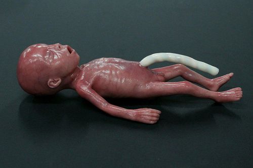 Manichino didattico per cure pediatriche - MICRO-PREEMIE - LifeCast Body Simulation Ltd - di pneumotorace / bebè / in silicone