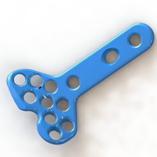 Placca di compressione per radio - 1306-4820 - SurgTech - distale / bloccata / in titanio