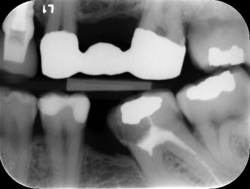 Software di rilevamento carie - ORCA DENTAL AI - di analisi delle immagini / diagnostico / clinico