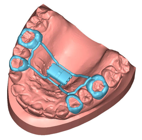 Software per laboratorio dentale - APPLIANCE - Coruo - ortodontico / per studio odontoiatrico / di progettazione