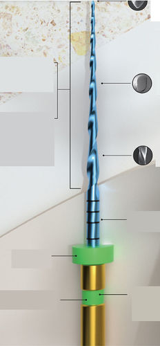 Punta odontoiatrica - E-FLEX ONE - Changzhou Sifary Medical Technology - metallizzata / dritta