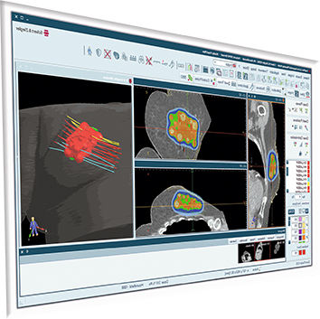 Software di pianificazione del trattamento - SagiPlan® - BEBIG MEDICAL GmbH - di valutazione / per tomografia computerizzata / MRI