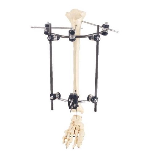 Fissatore esterno per tibia - WZ00 series - Wuhan Yijiabao Biological Materials - per femore / tubolare / per adulti