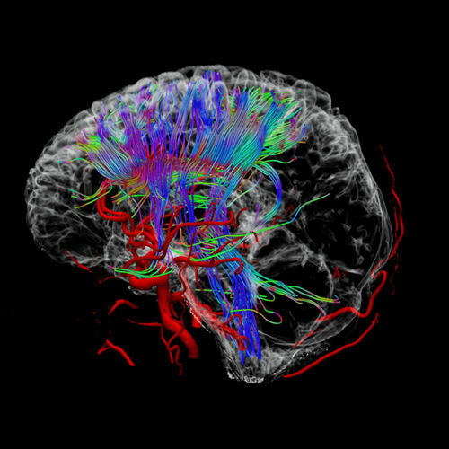 Software di analisi - uVIEWER - Shanghai United Imaging - di visualizzazione / di trattamento / medico