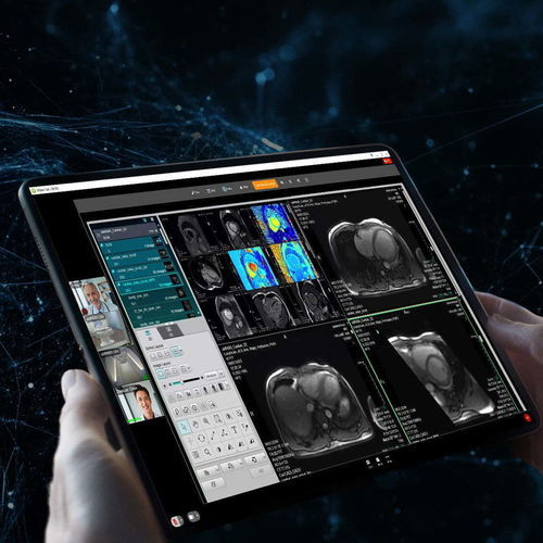 Sistema di gestione e comunicazione di visualizzazione - uOmniscan - Shanghai United Imaging - di file DICOM / per PACS / video