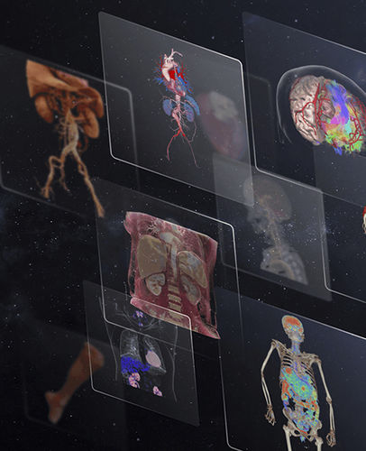 Software medico - uOmnispace - Shanghai United Imaging - chirurgico / per cardiologia / per tomografia computerizzata