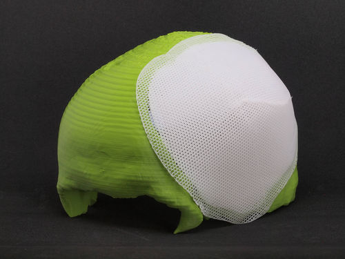 Impianto cranico assorbibile - Osteoplug™ - Osteopore International