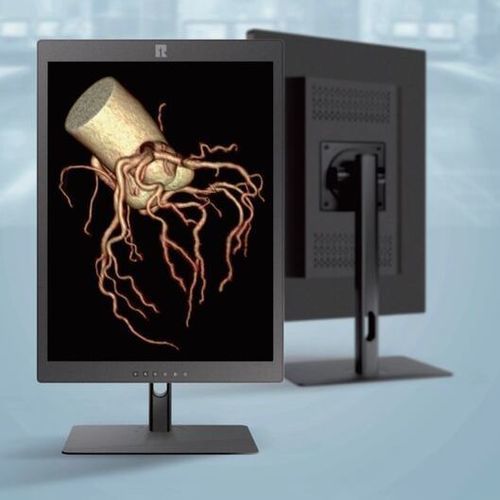 Monitor per diagnostica per immagini - Shenzhen Kenid Medical Devices - di segnali vitali / ad alta definizione
