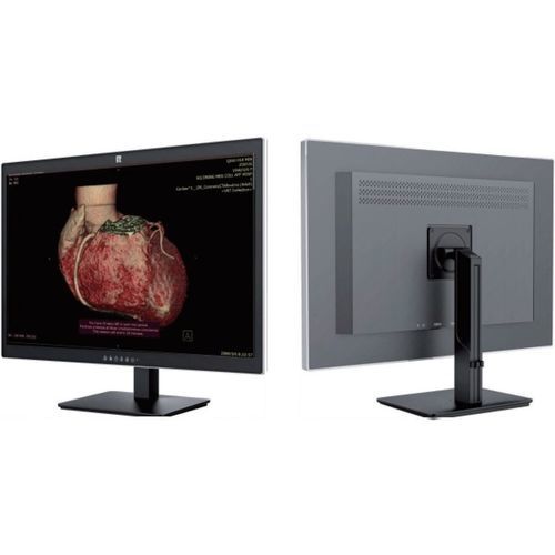 Monitor medico - Shenzhen Kenid Medical Devices - per radiologia / ad alta definizione