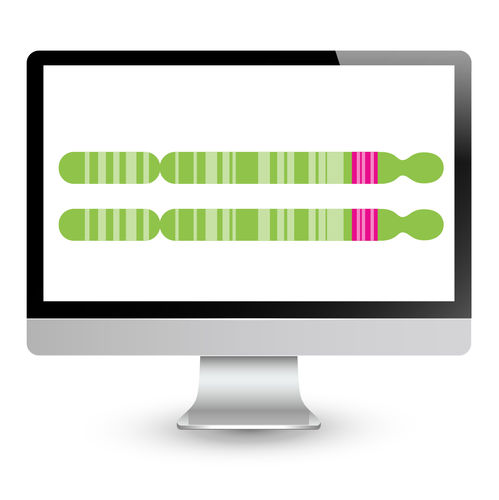 Analizzatore di biologia molecolare per diagnosi di FSHD - EnFocus™ - Bionano Genomics