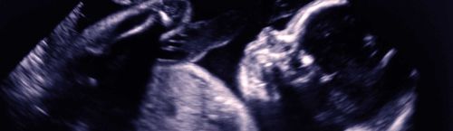 Software di analisi - Congenica Prenatal™ - Congenica Ltd - diagnostico / medico / clinico