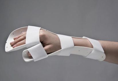 Steccobenda per metacarpo - A401 series - Klarity Medical - L / M / S