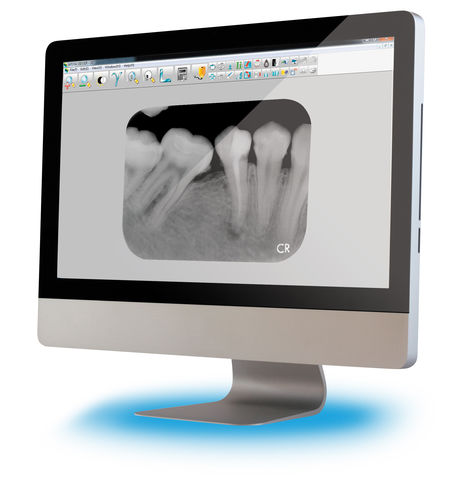 Software per imaging odontoiatrico - Apixia - visualizzatore / di trattamento / odontoiatrico