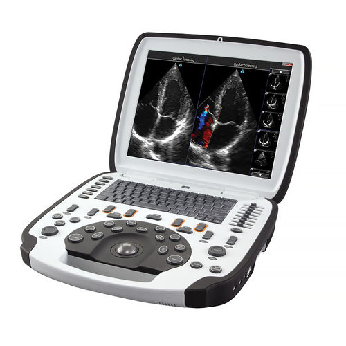 Ecografo portatile - uSmart3300 NexGen - DELBio - per ecografia multidisciplinare / in bianco e nero / con doppler a colori