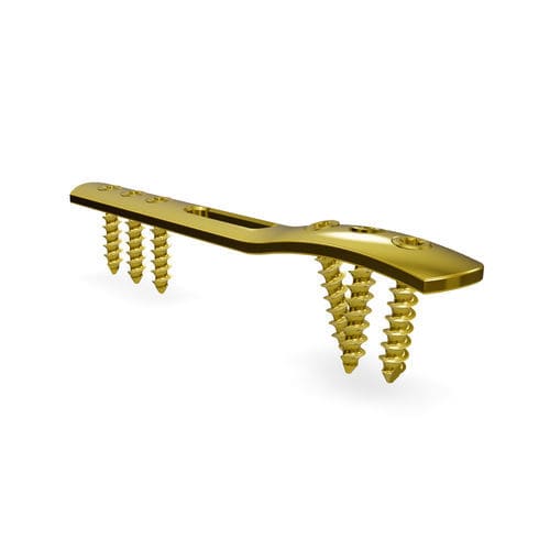 Placca di compressione per malleolo - Malleolus 3.5 locking compression plate - Astrolabe - distale / laterale / bloccata
