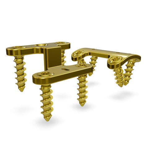 Placca di compressione per metatarso - Rearfoot 3.5 system - Astrolabe - laterale / mediale / bloccata