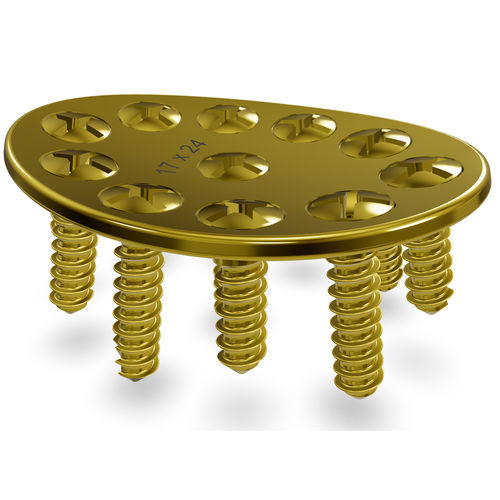 Placca per artrodesi per carpo - CMS 2.3 Modular System - Astrolabe - mediale / bloccata / in titanio