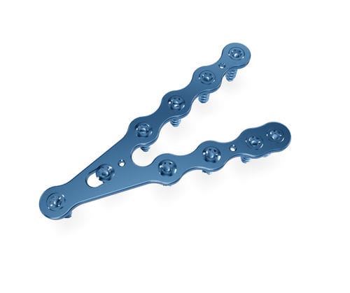 Placca di compressione per radio - SMA 2,7 mm System  - Astrolabe - distale / bloccata / in metallo
